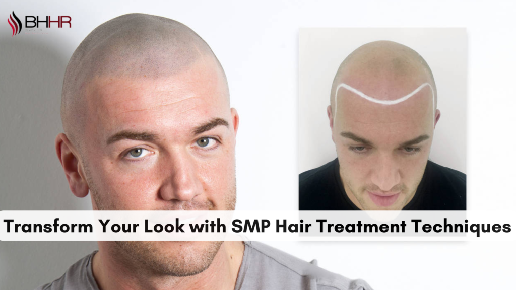 smp hair treatment